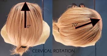 range of motion cervical rotation